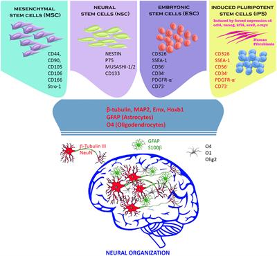 Potential of Stem Cell-Based Therapy for Ischemic Stroke